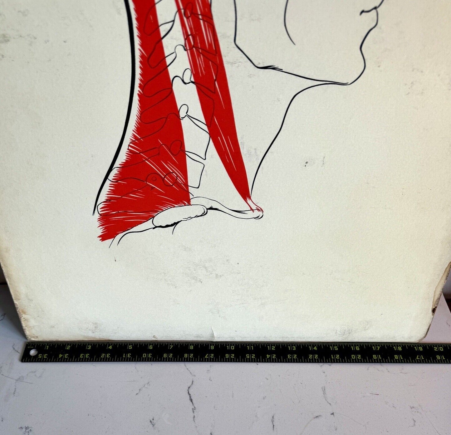 Vintage Mid Century Medical Neck Chart Art