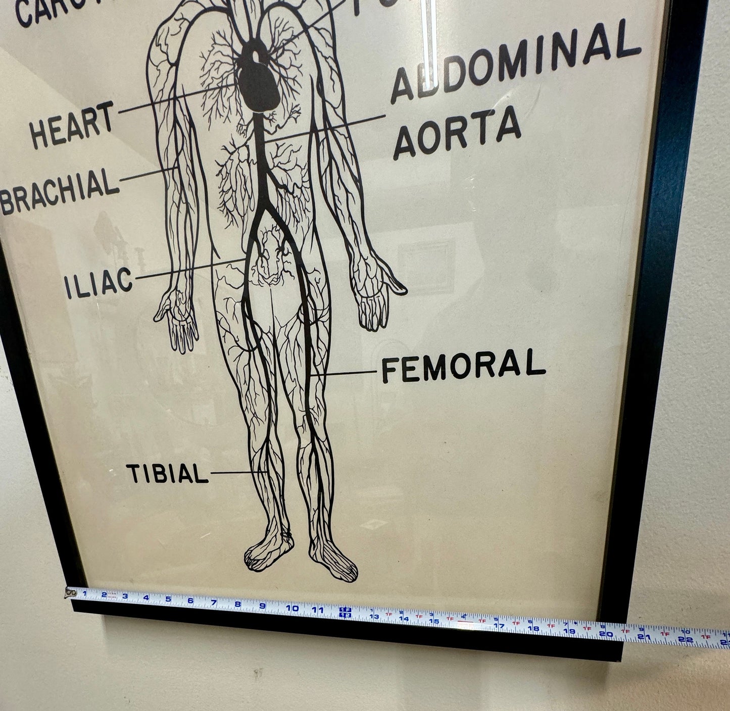 Vintage Mid Century Anatomy Aterial Circulation Medical Framed Poster
