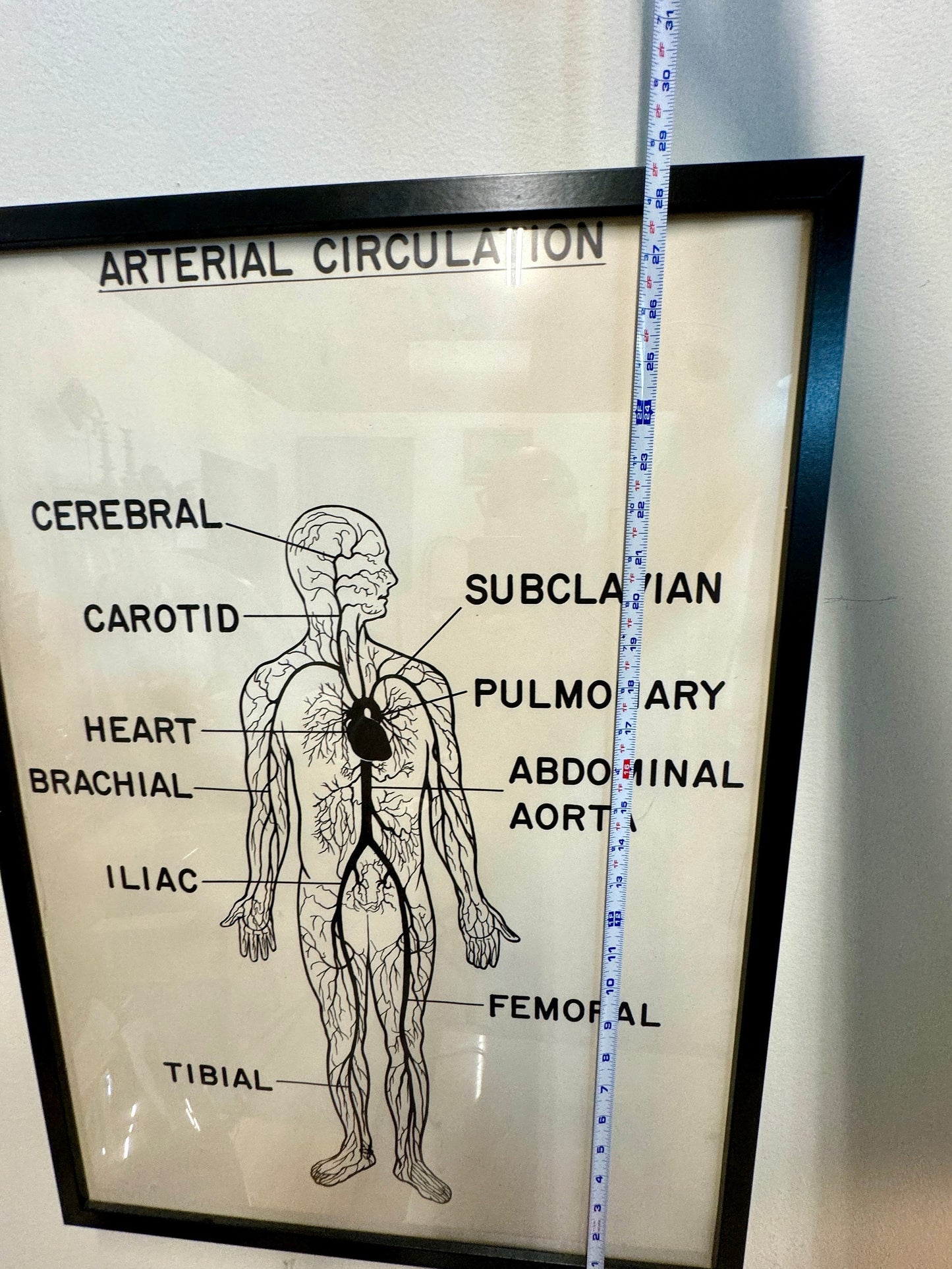 Vintage Mid Century Anatomy Aterial Circulation Medical Framed Poster